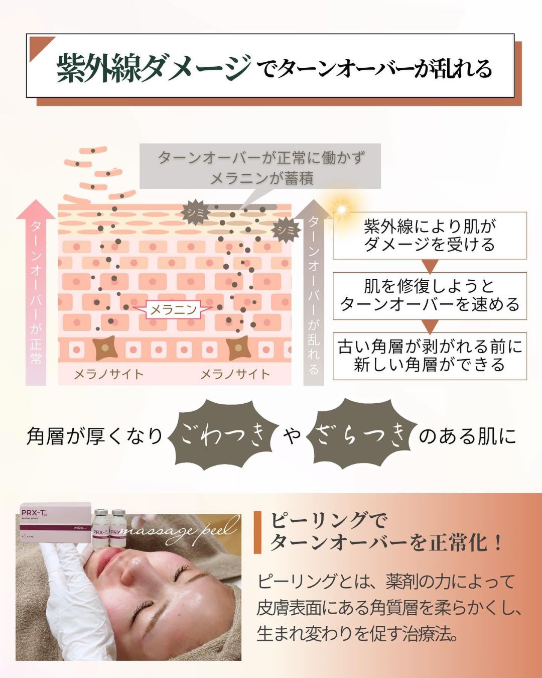 紫外線ダメージ