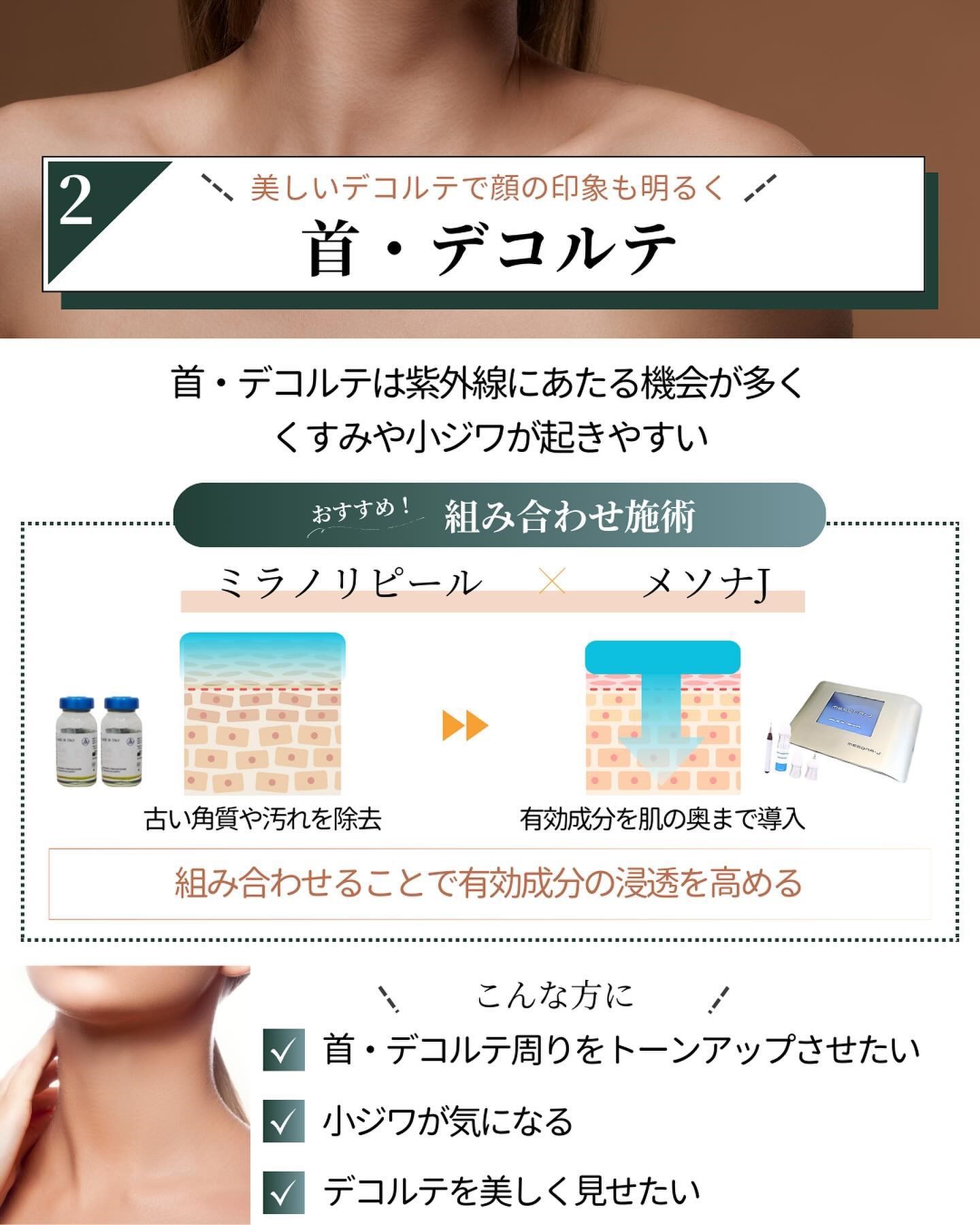 ミラノリピールとメソナJ