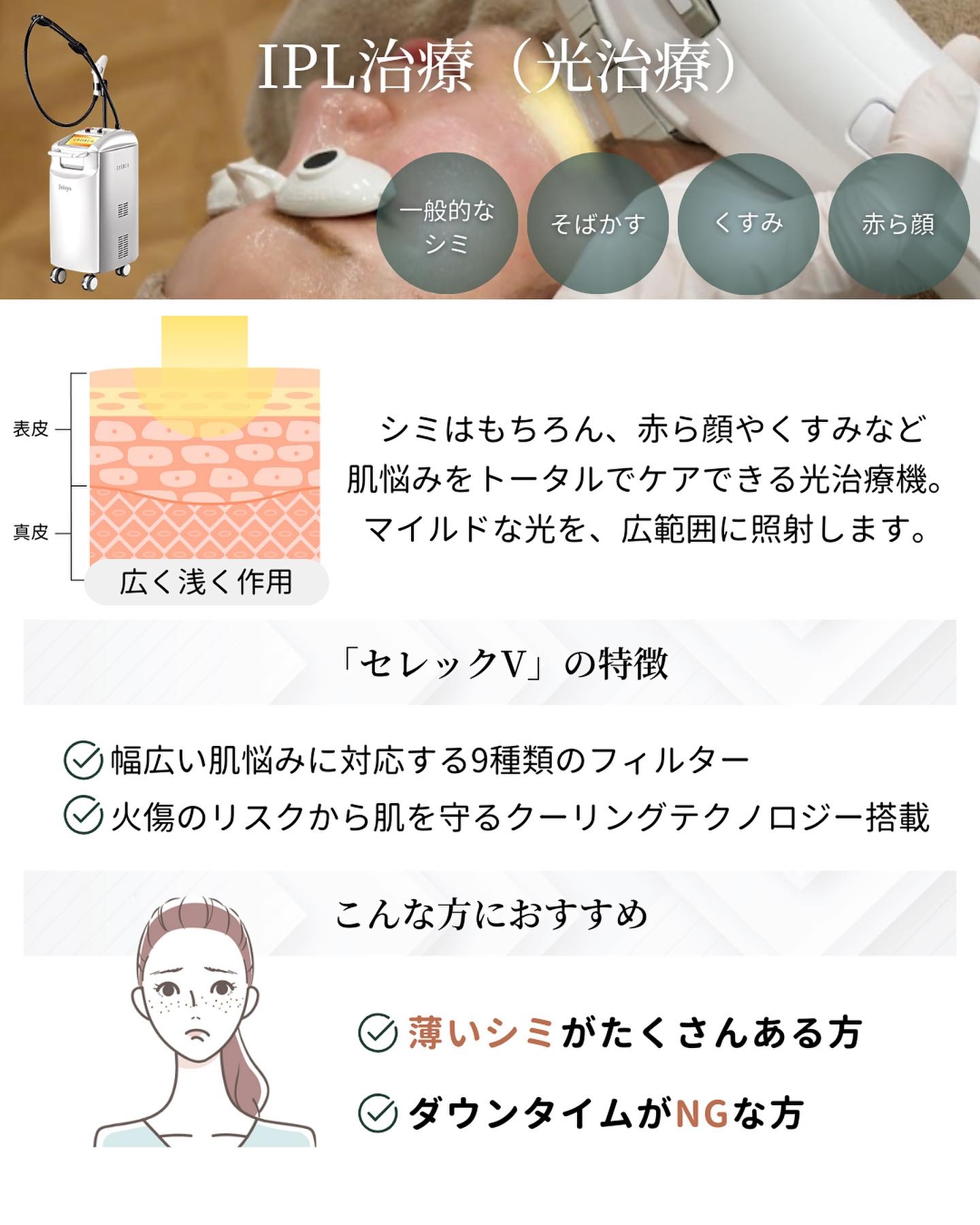 IPL治療（光治療）に使われるセレックVの特徴