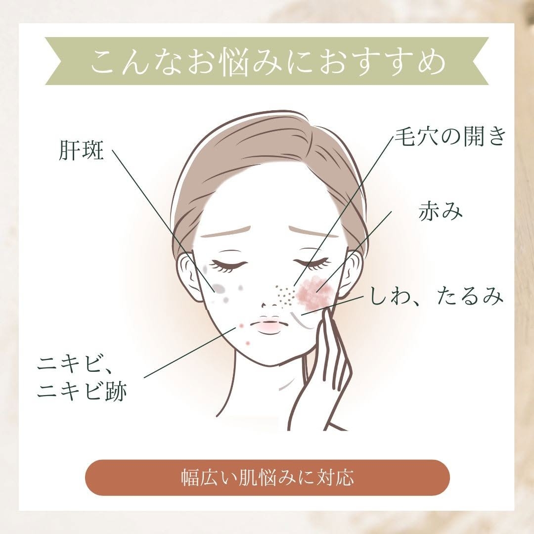 こんなお悩みにおすすめ