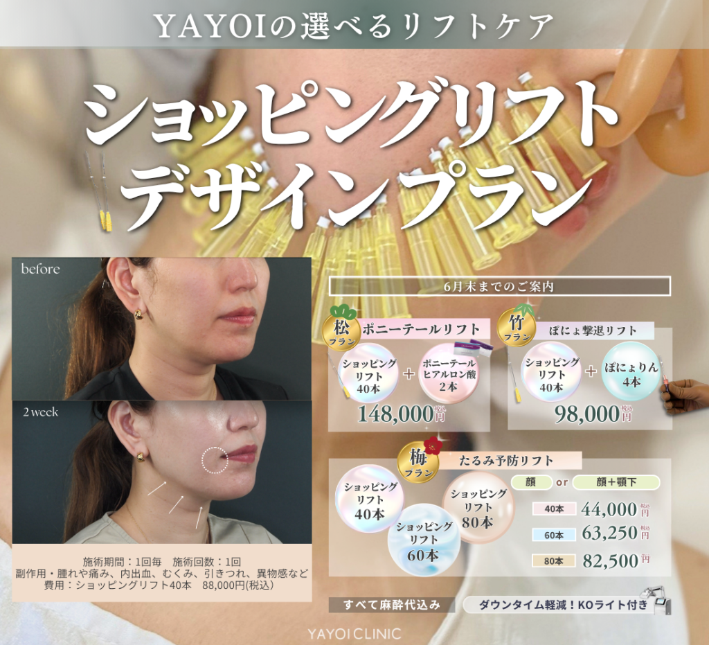 6月末日までのご案内☔｜ショッピングリフト デザインプラン