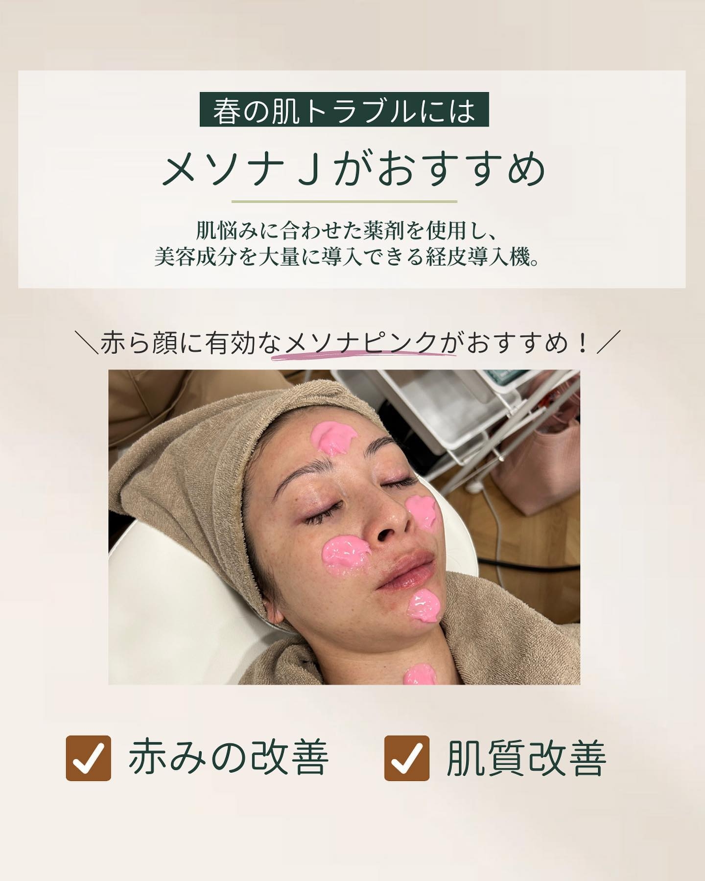 メソナJ