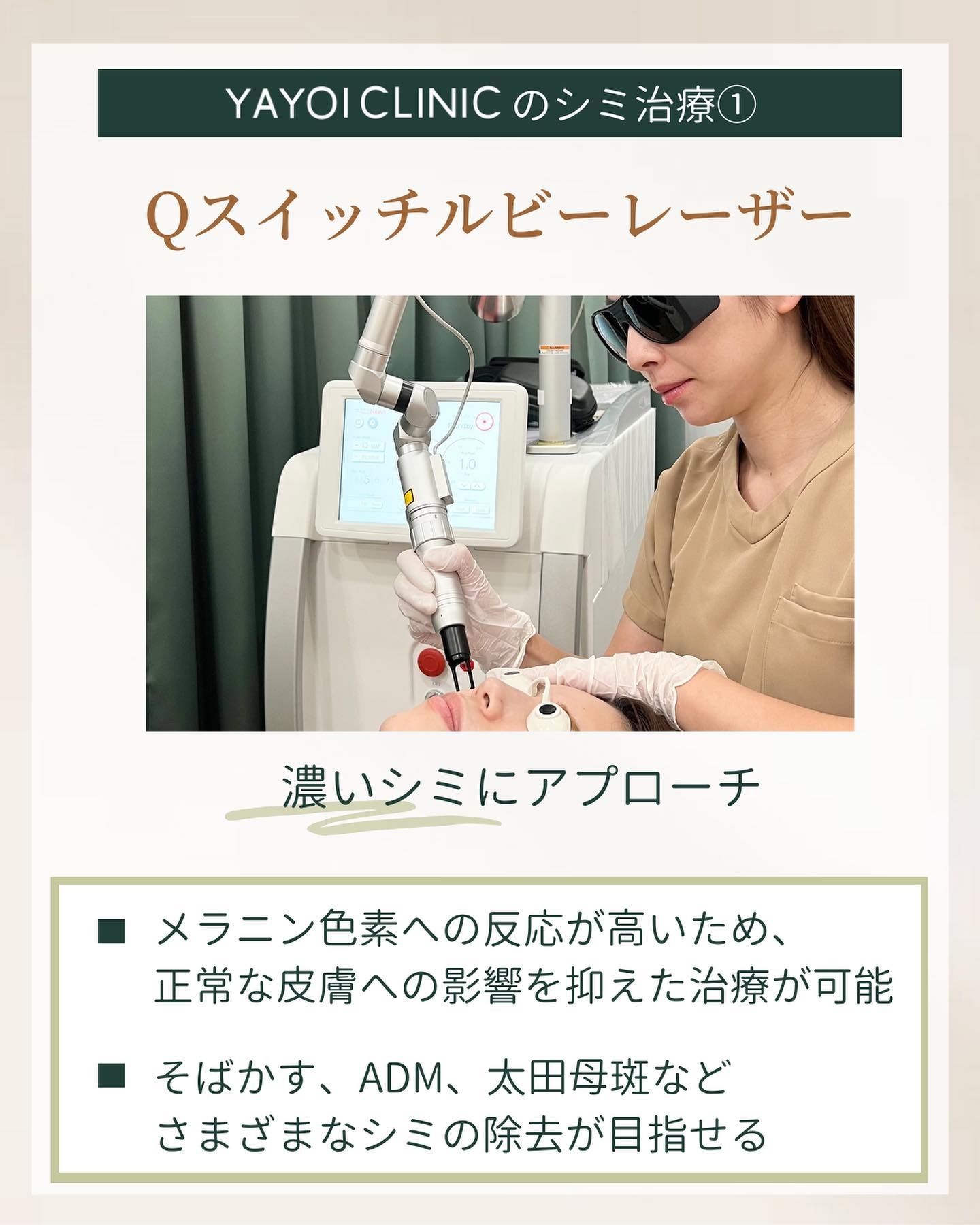 Qスイッチルビーレーザー