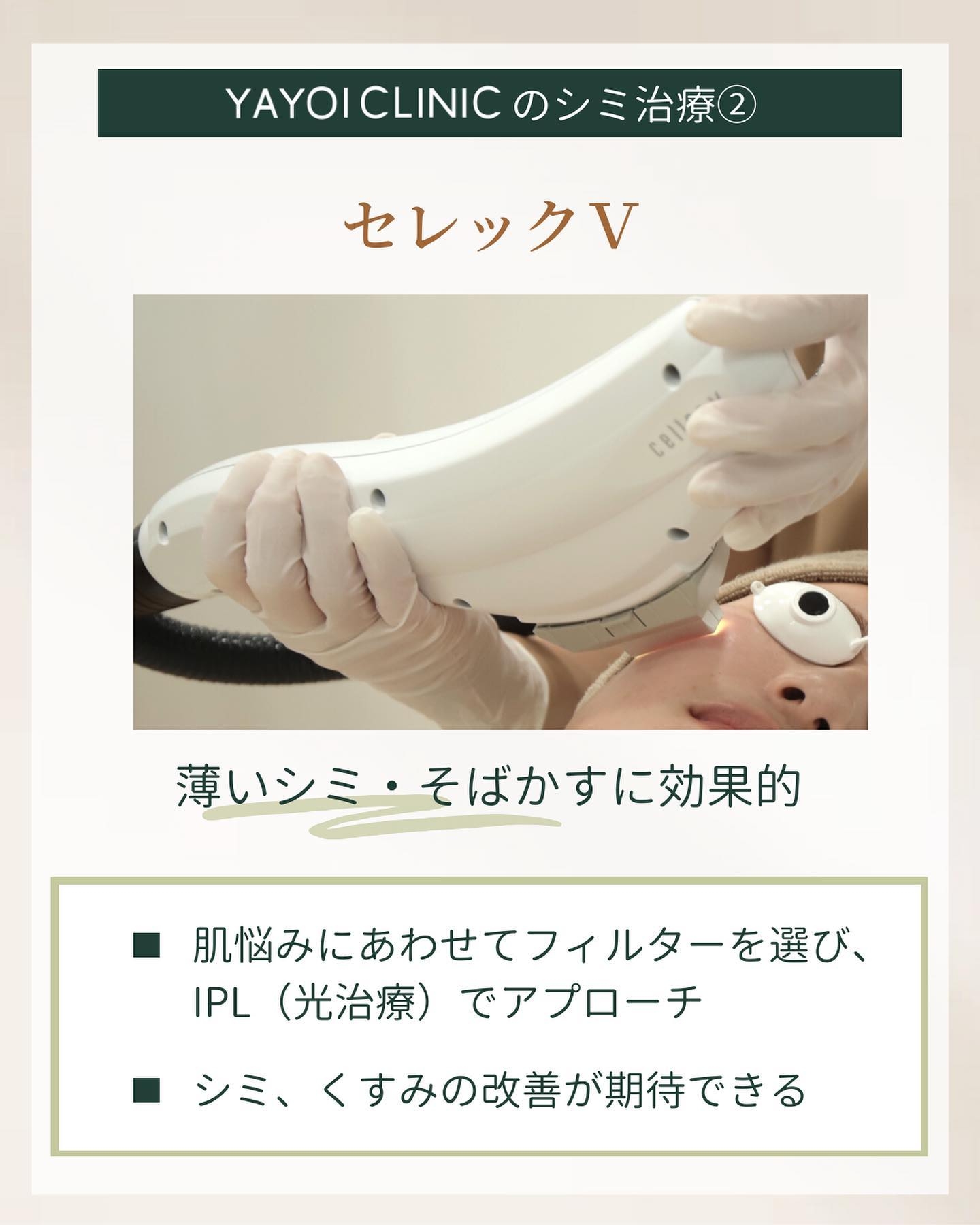 セレックV