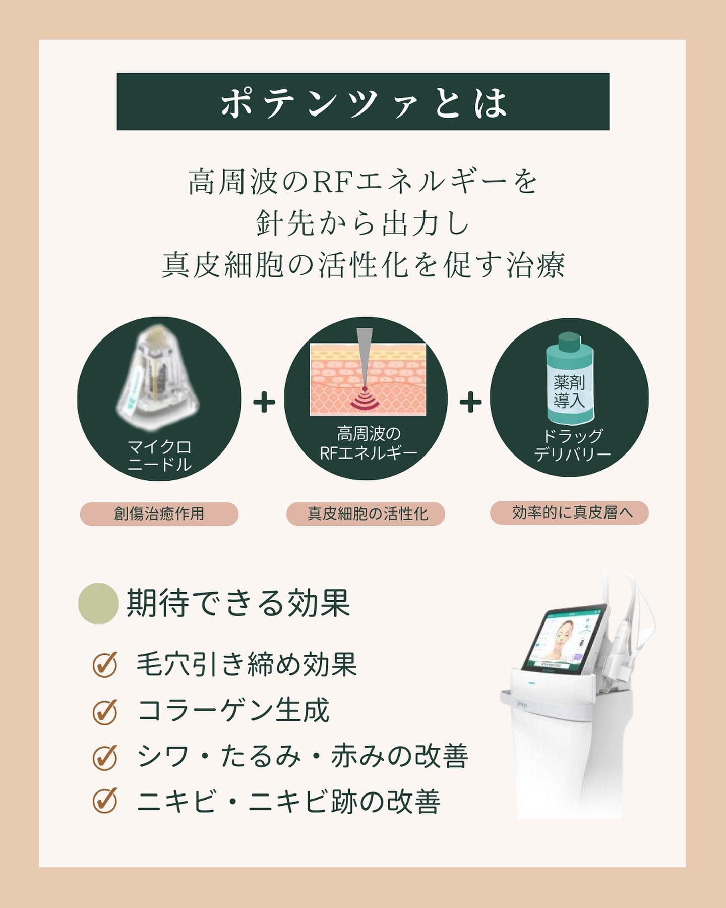 ポテンツァとは