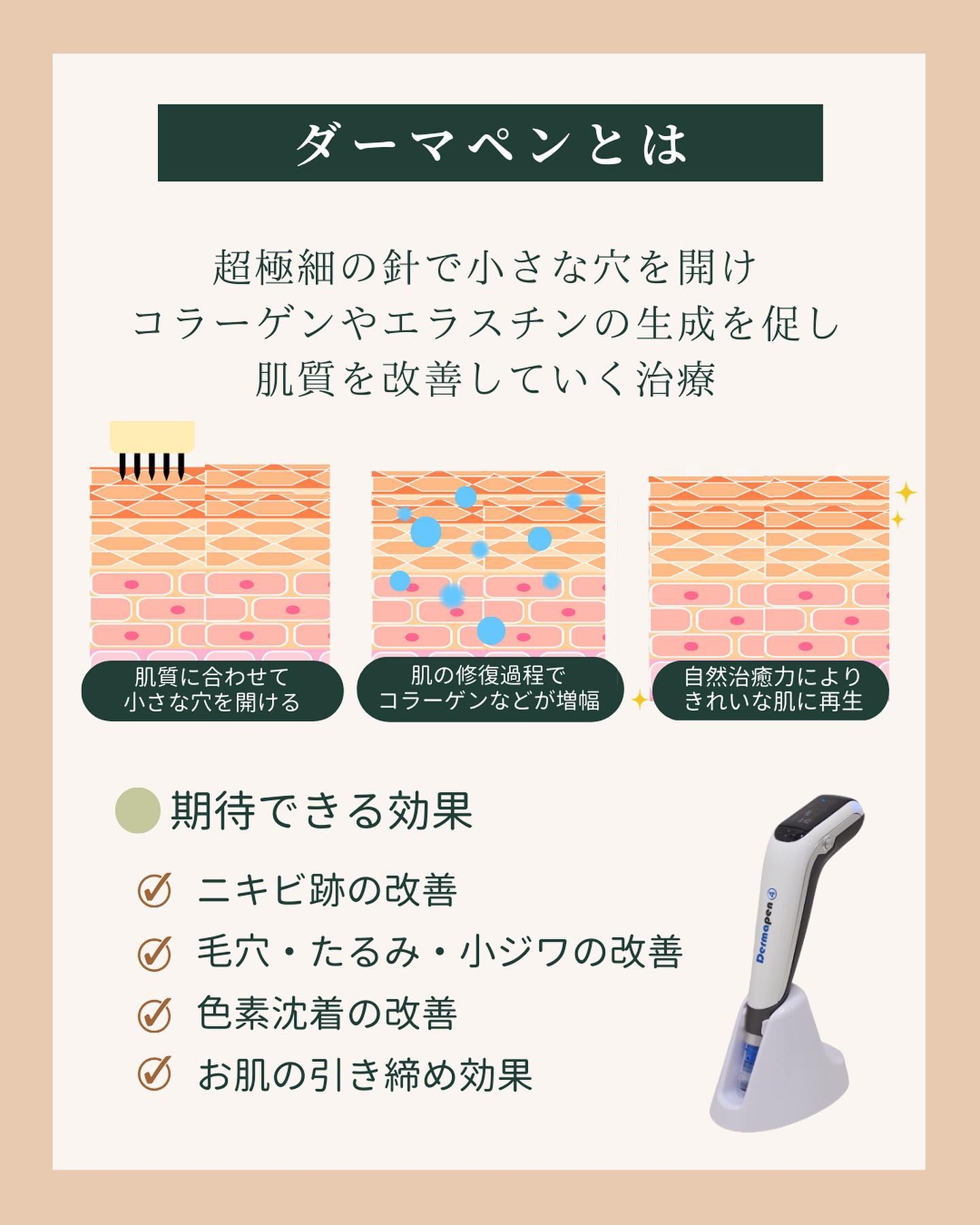 ダーマペンとは