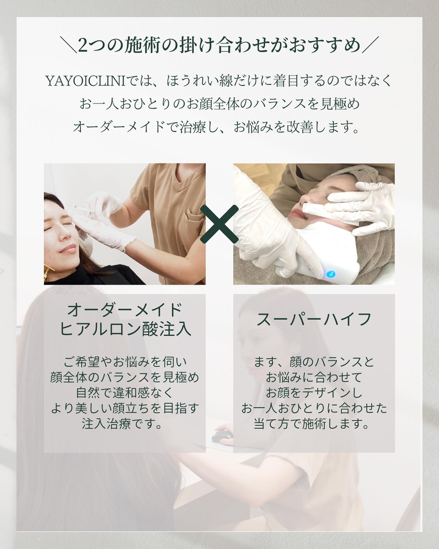 ヒアルロン酸注入とスーパーハイフを組み合わせたオーダーメイドのほうれい線治療