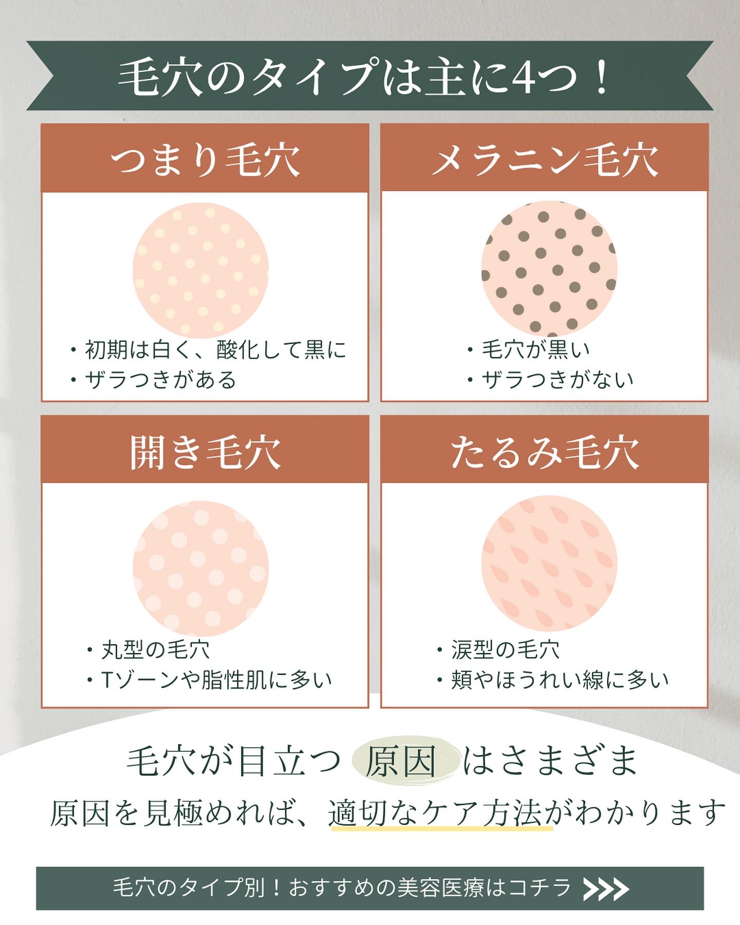 毛穴 種類