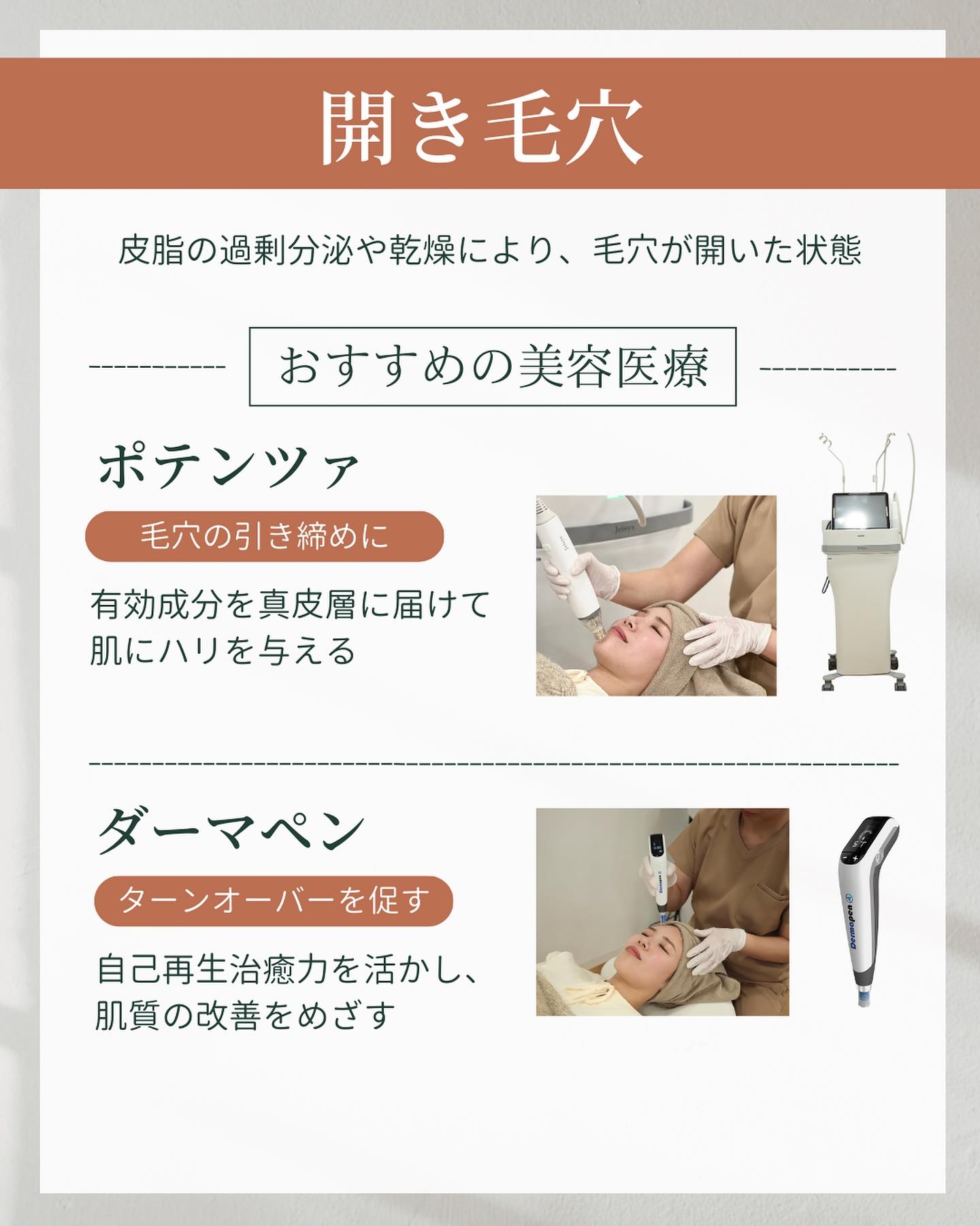 開き毛穴 治し方