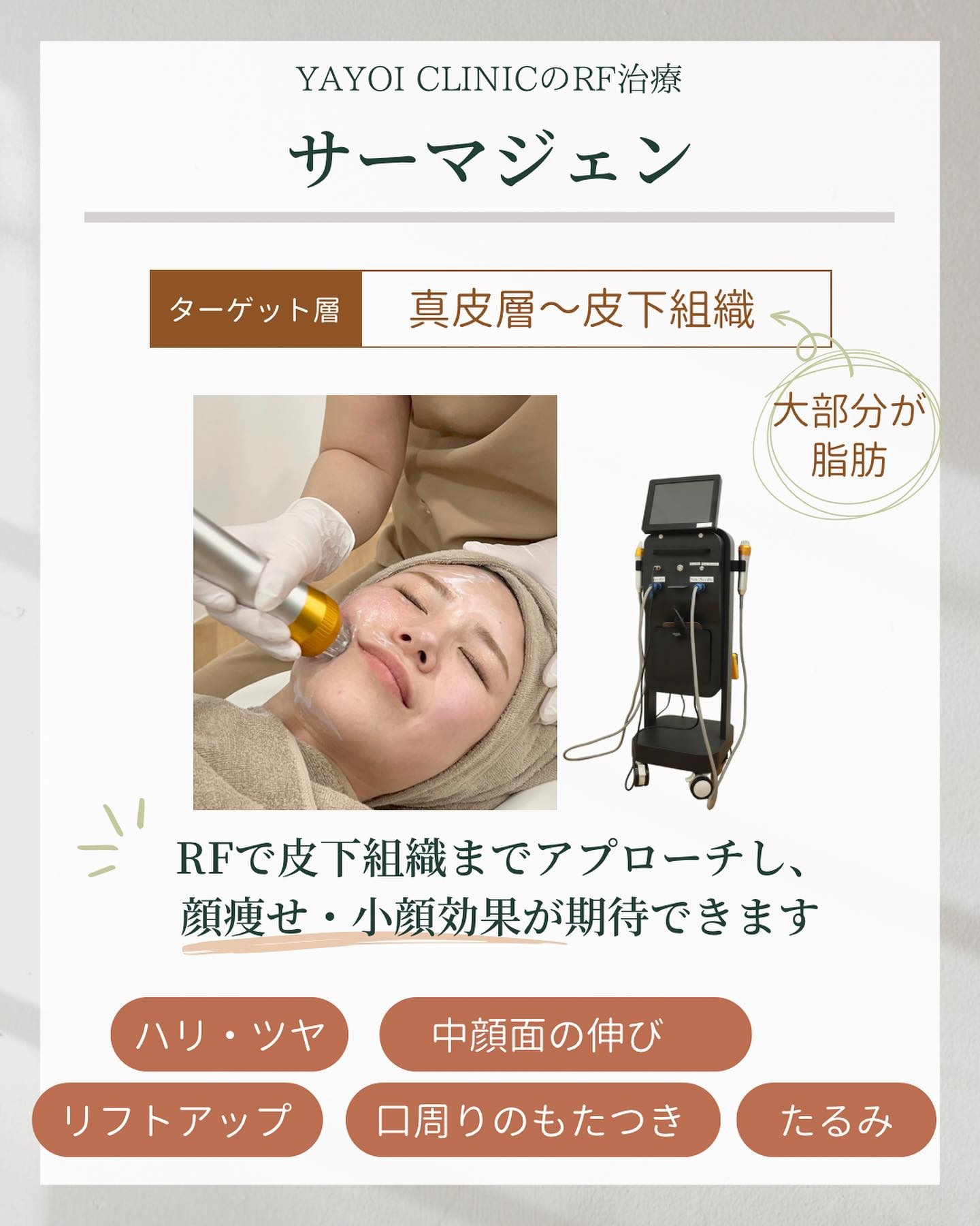 RF治療　サーマジェン