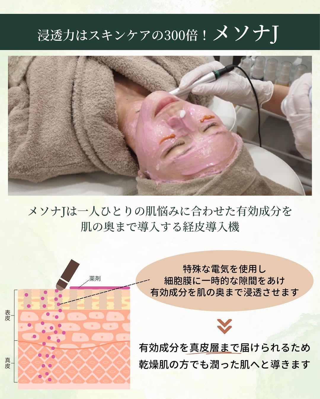 メソナJの施術で肌の奥(細胞間隙)まで有効成分を浸透させる仕組みを表した解説イラスト