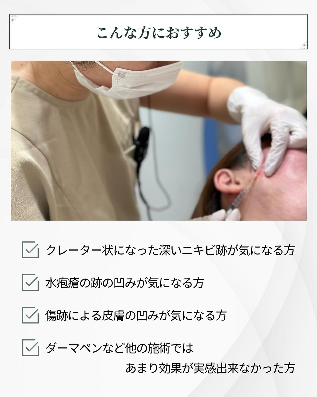サブシジョン おすすめ クレーター 水疱瘡 水ぼうそう 痕 傷痕