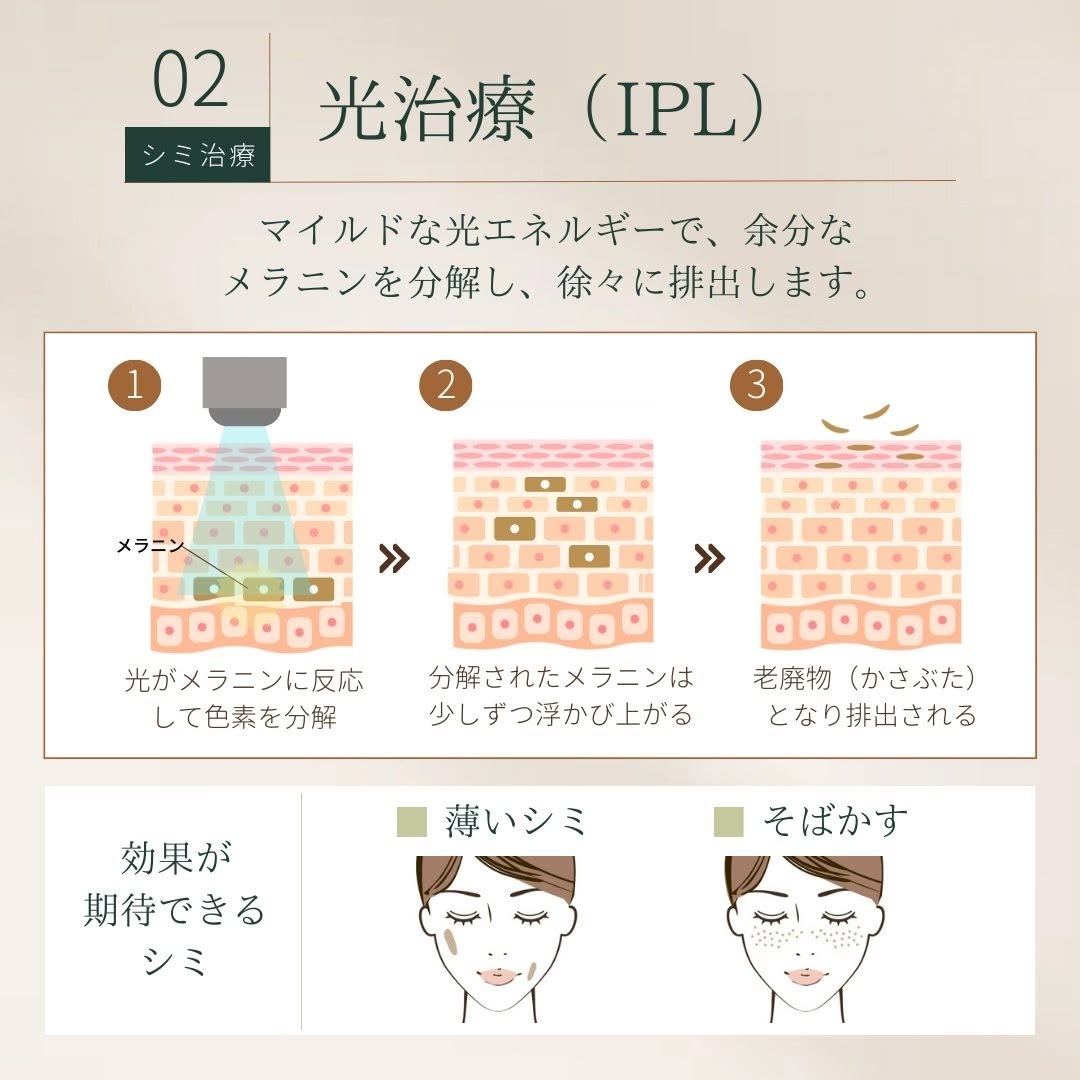 光治療(IPL)