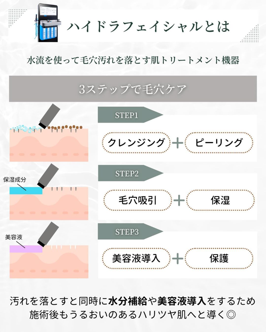 ハイドラフェイシャルとは 
