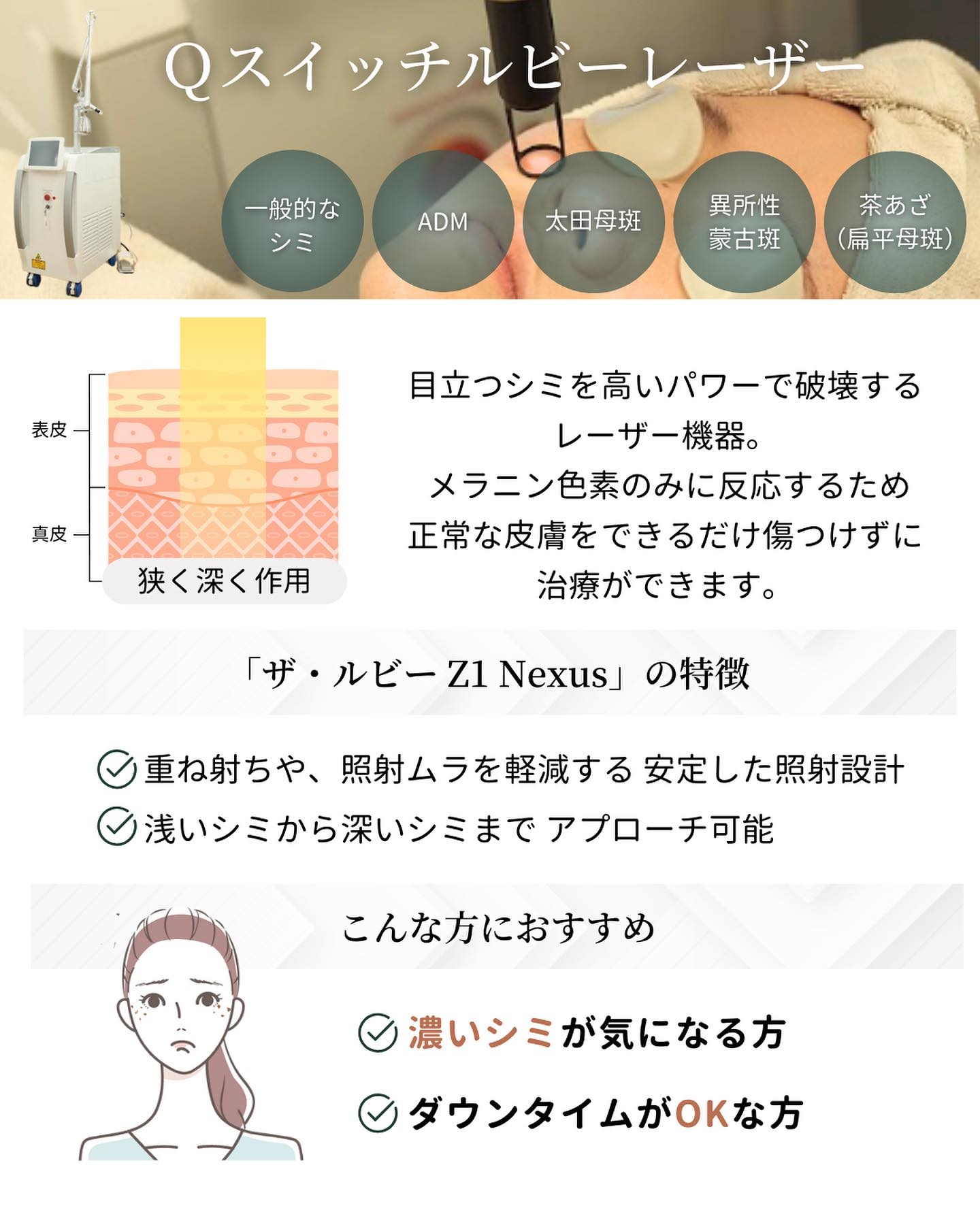 レーザー治療に使われるQスイッチルビーレーザーの特徴