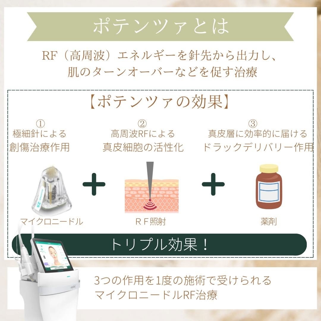 ポテンツァとは