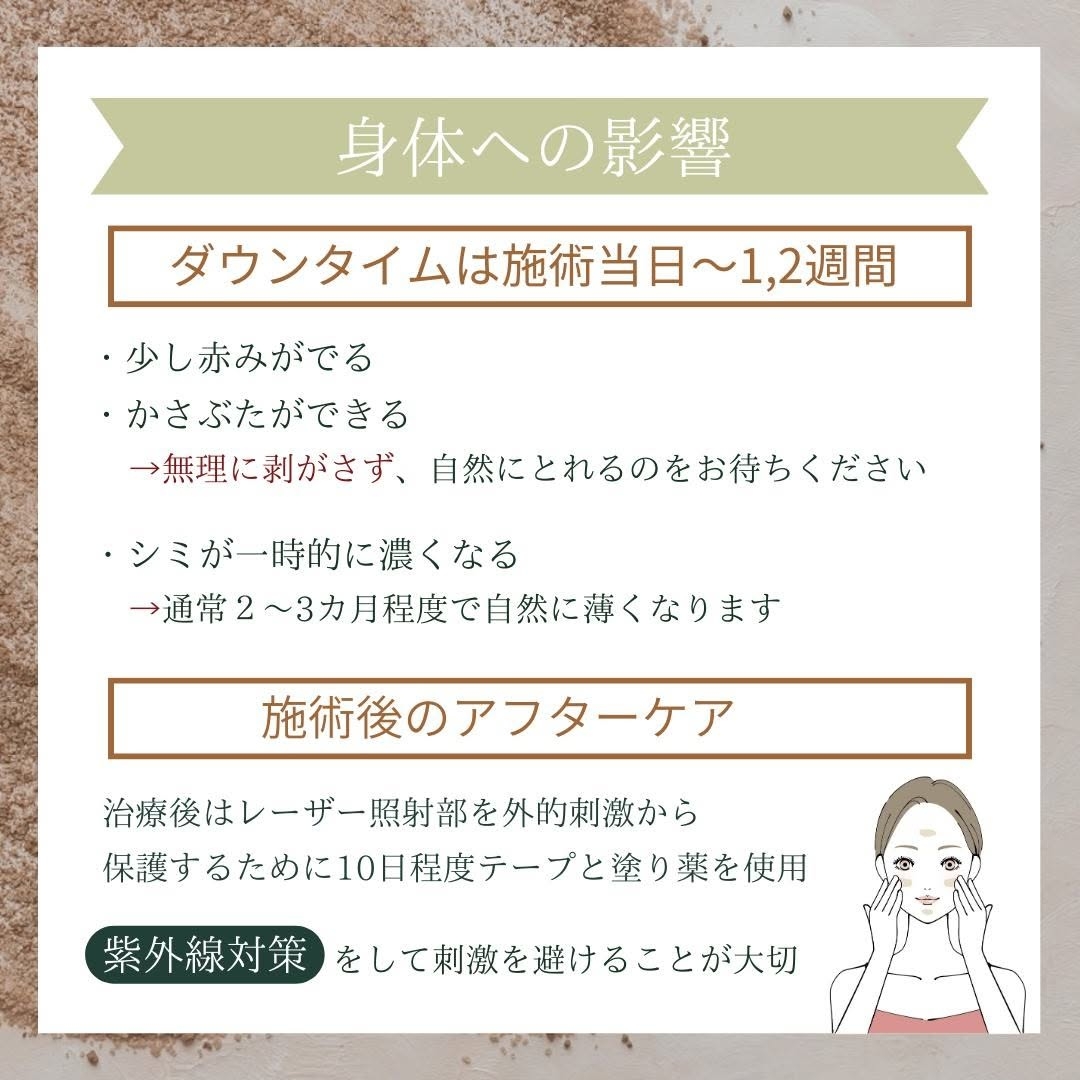 Qスイッチルビーレーザー注意点