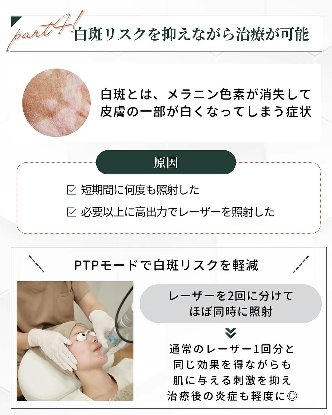 トライビームの特徴