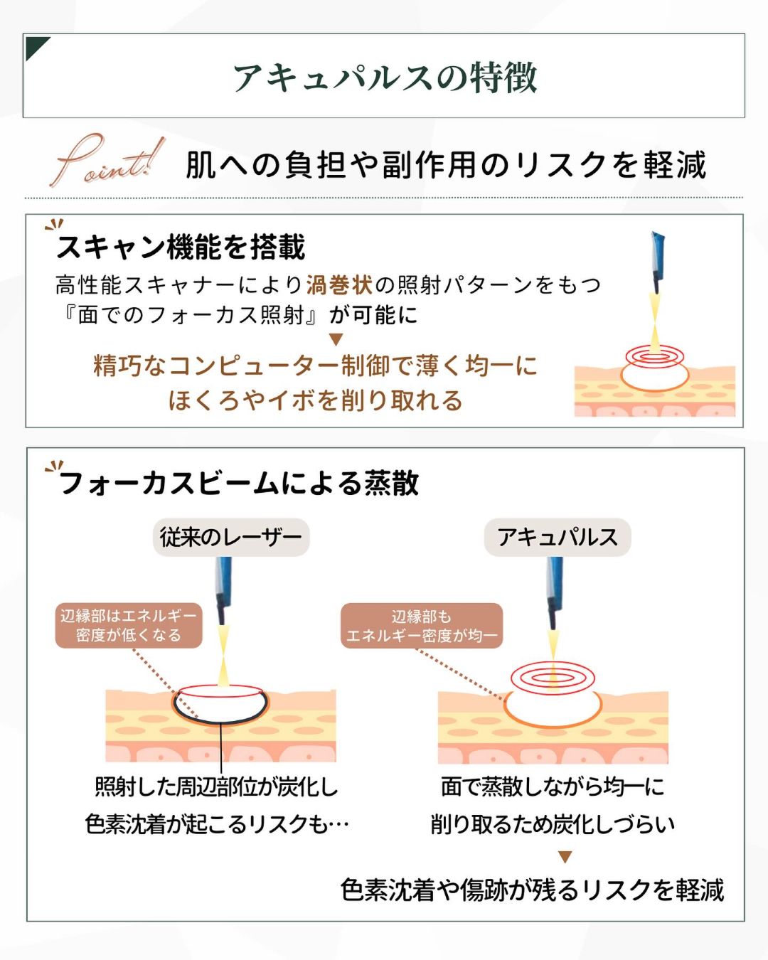 アキュパルスの特徴