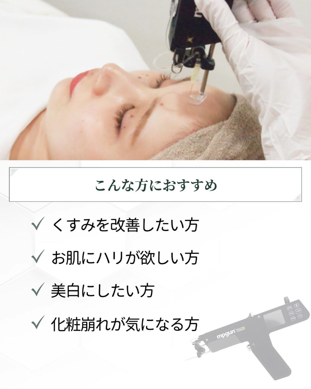 メソガンがおすすめの人