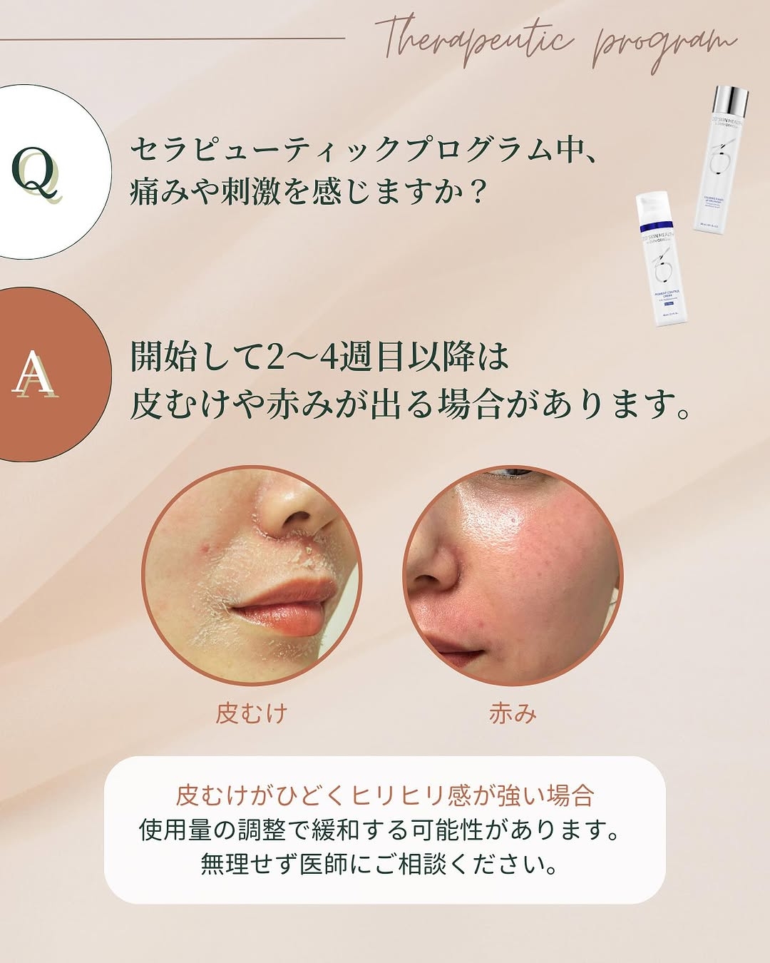 セラピューティックプログラム中の痛みや刺激