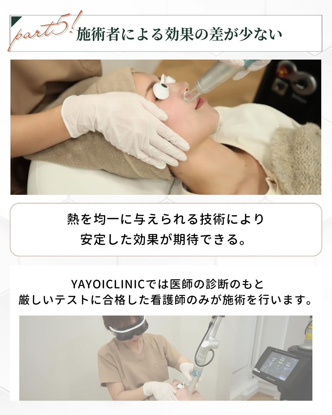 トライビームの特徴