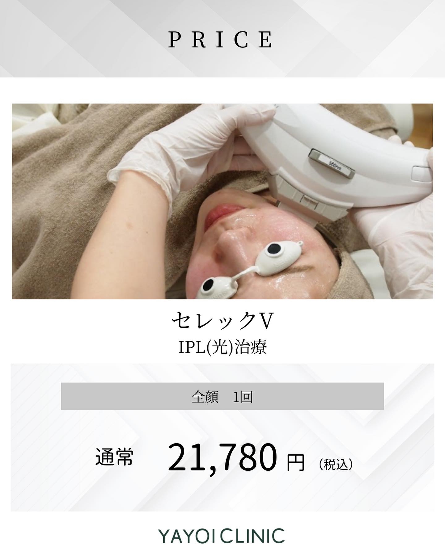 ヤヨイクリニックのセレックV|料金