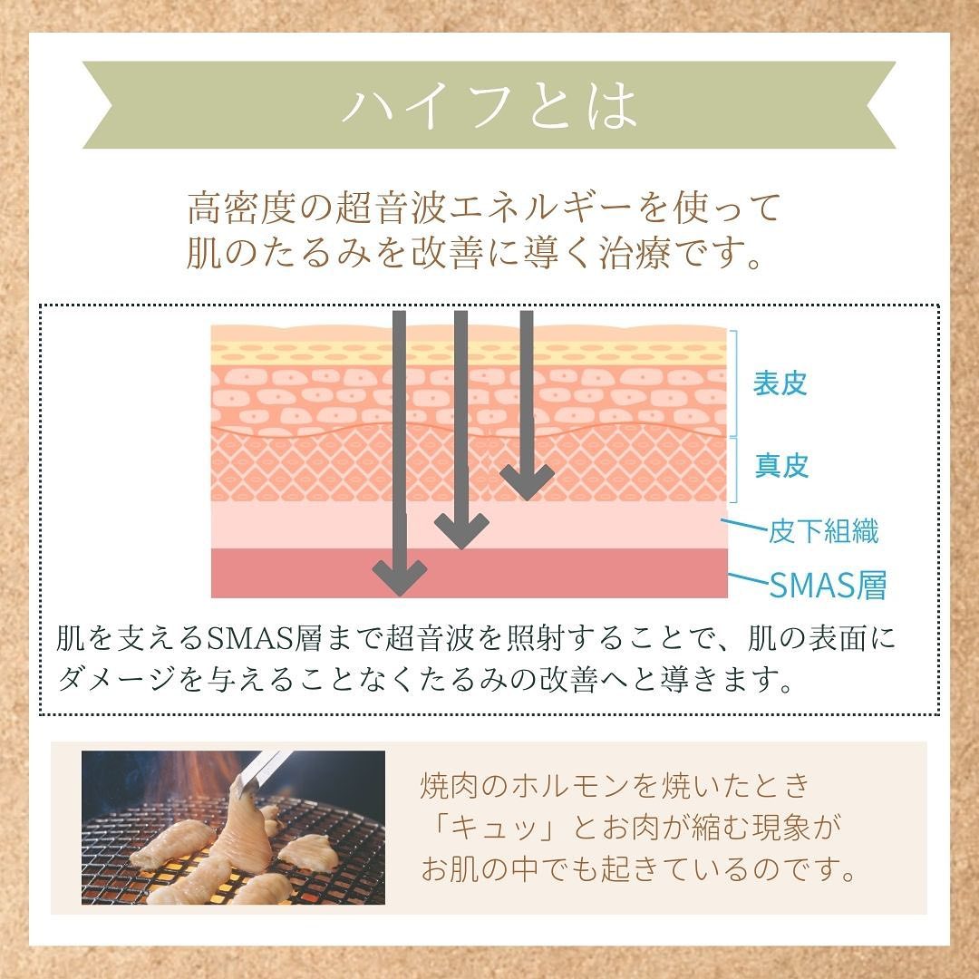 ハイフの仕組み