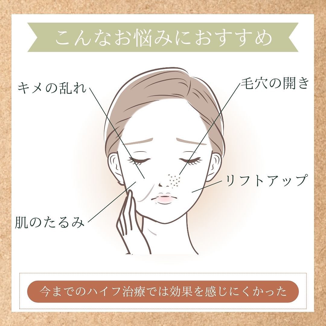 スーパーハイフが向いている人