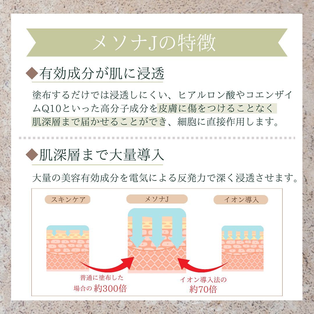 メソナJの特徴