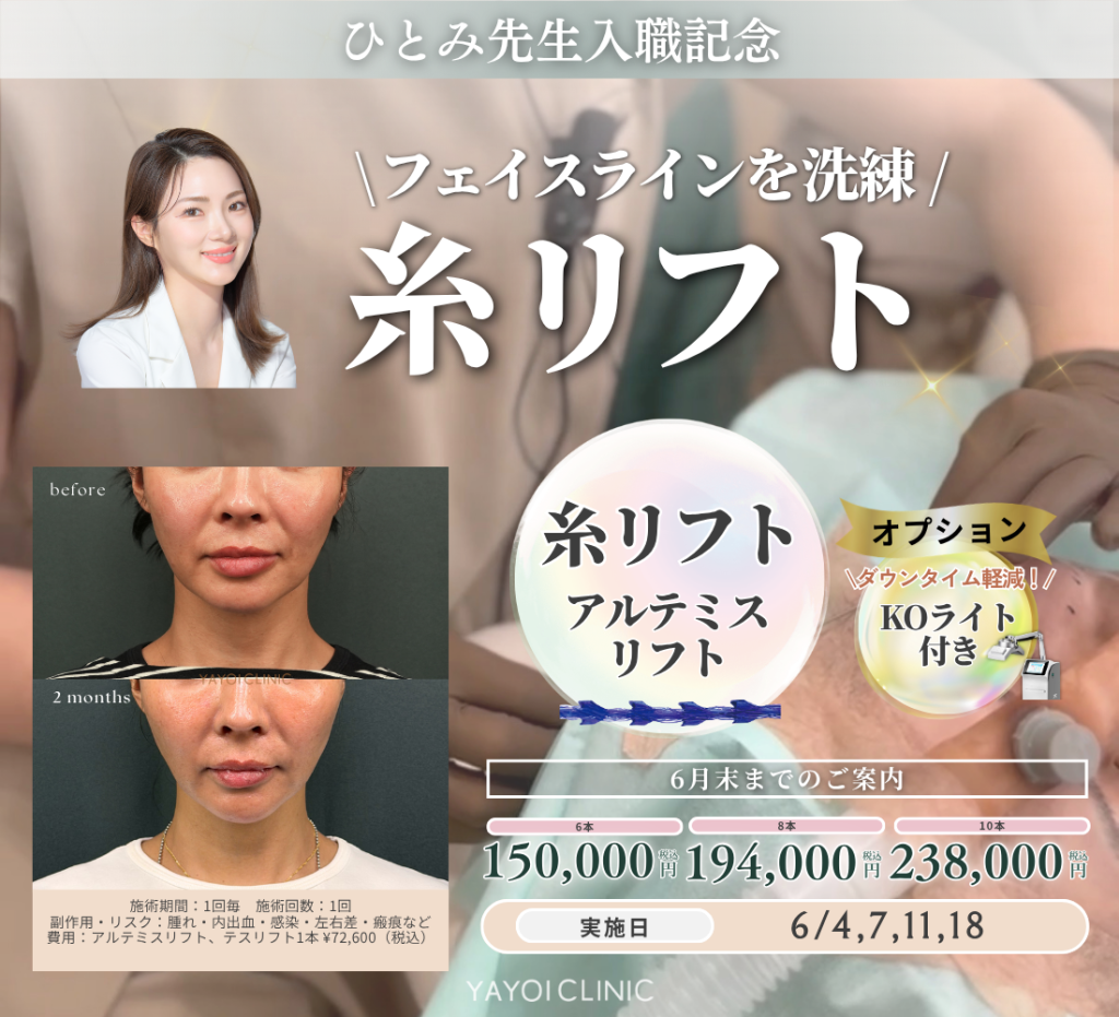 6月末日までのご案内☔｜糸リフト