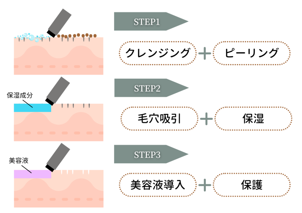 広島でハイドラフェイシャルを受ける!クリニック選びのポイントを解説
