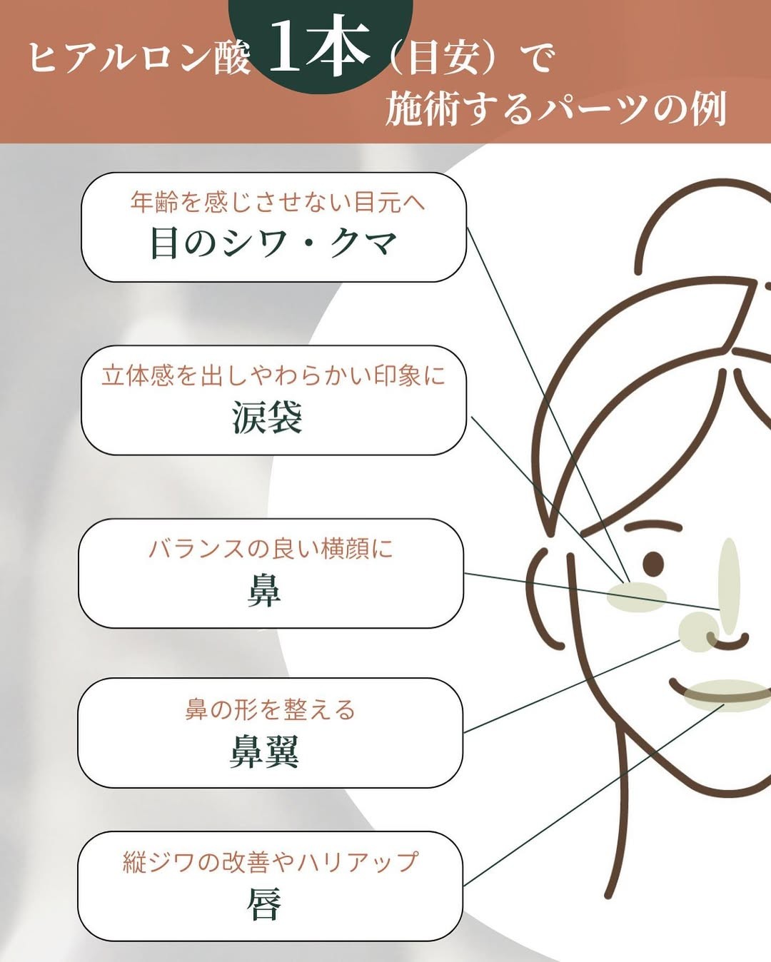 ヒアルロン酸1本で施術するパーツ例