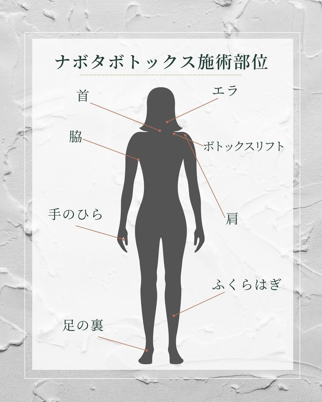 ナボタボトックスの施術部位