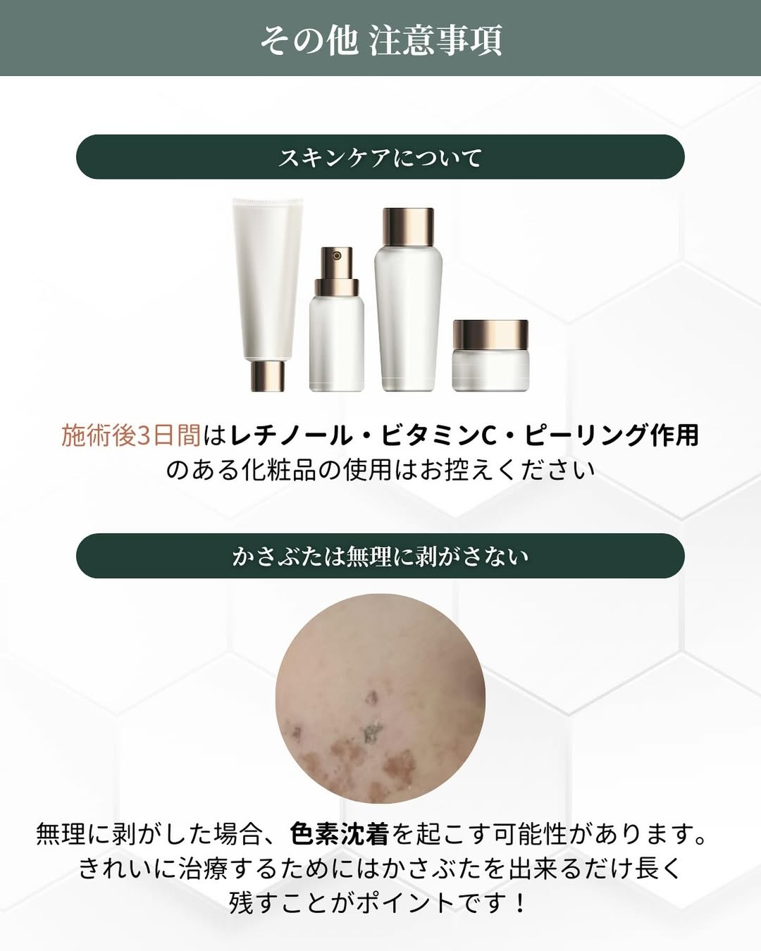 シミ取り後 スキンケア