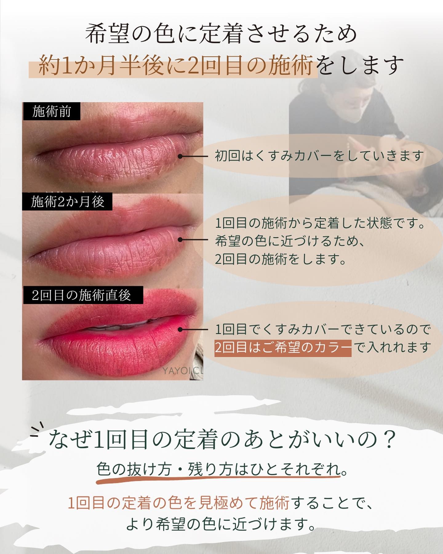 希望の色に定着させるため2回施術をする
