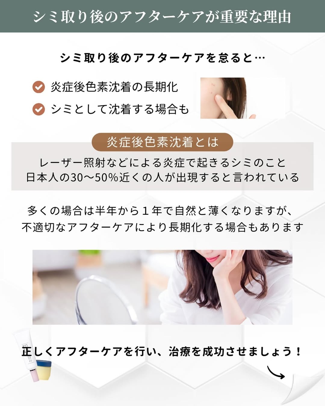 シミ取り後のケア 大切な理由