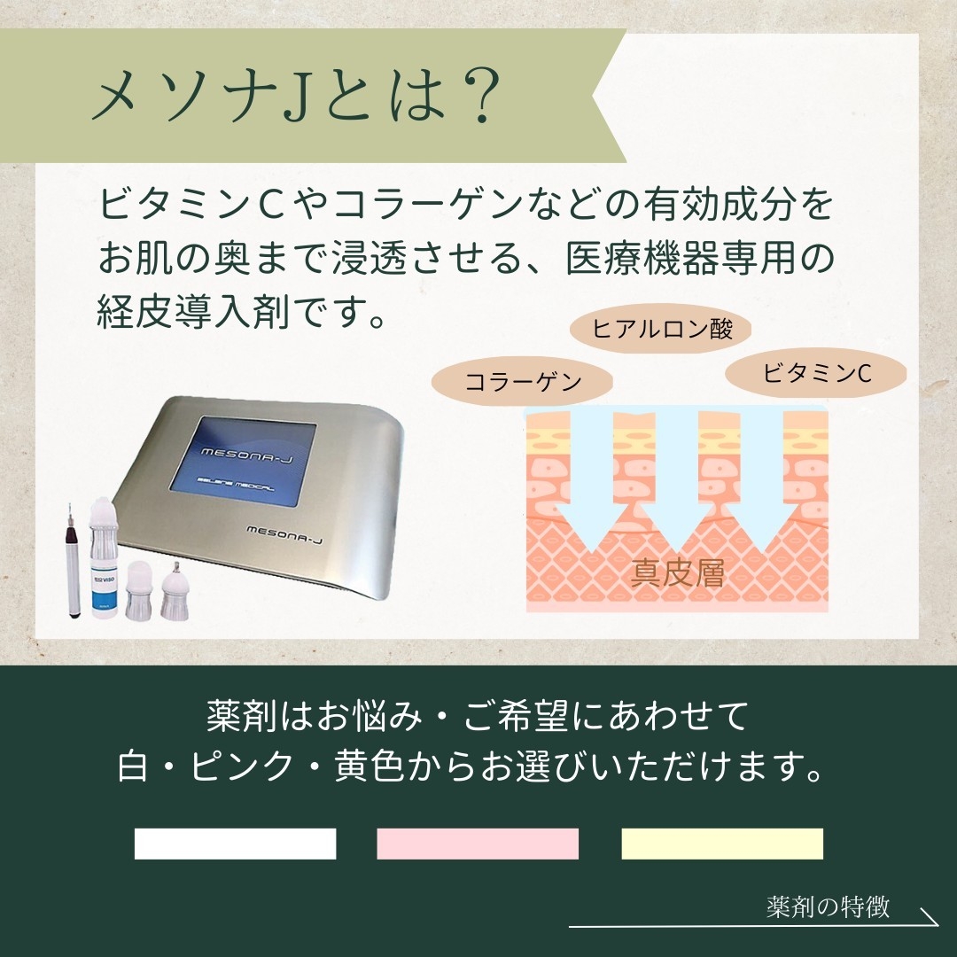 メソナJとは