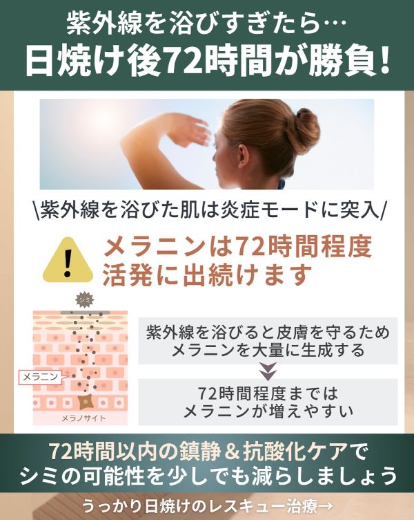 紫外線を浴びすぎたら72時間が勝負！