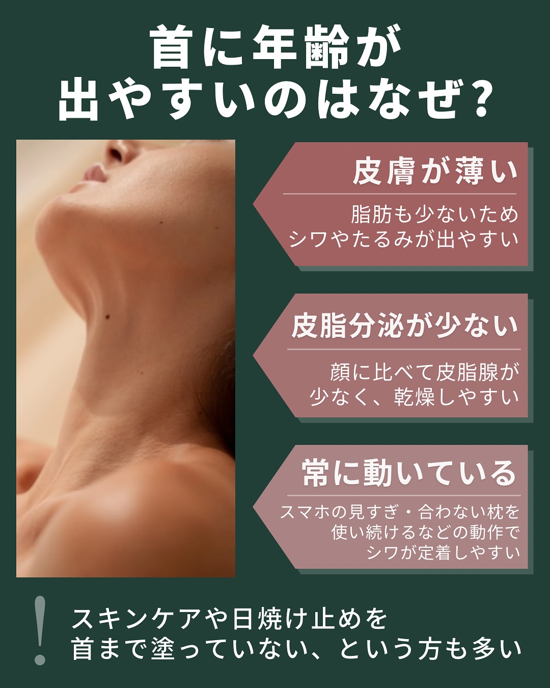 首に年齢が出やすいのはなぜ?
