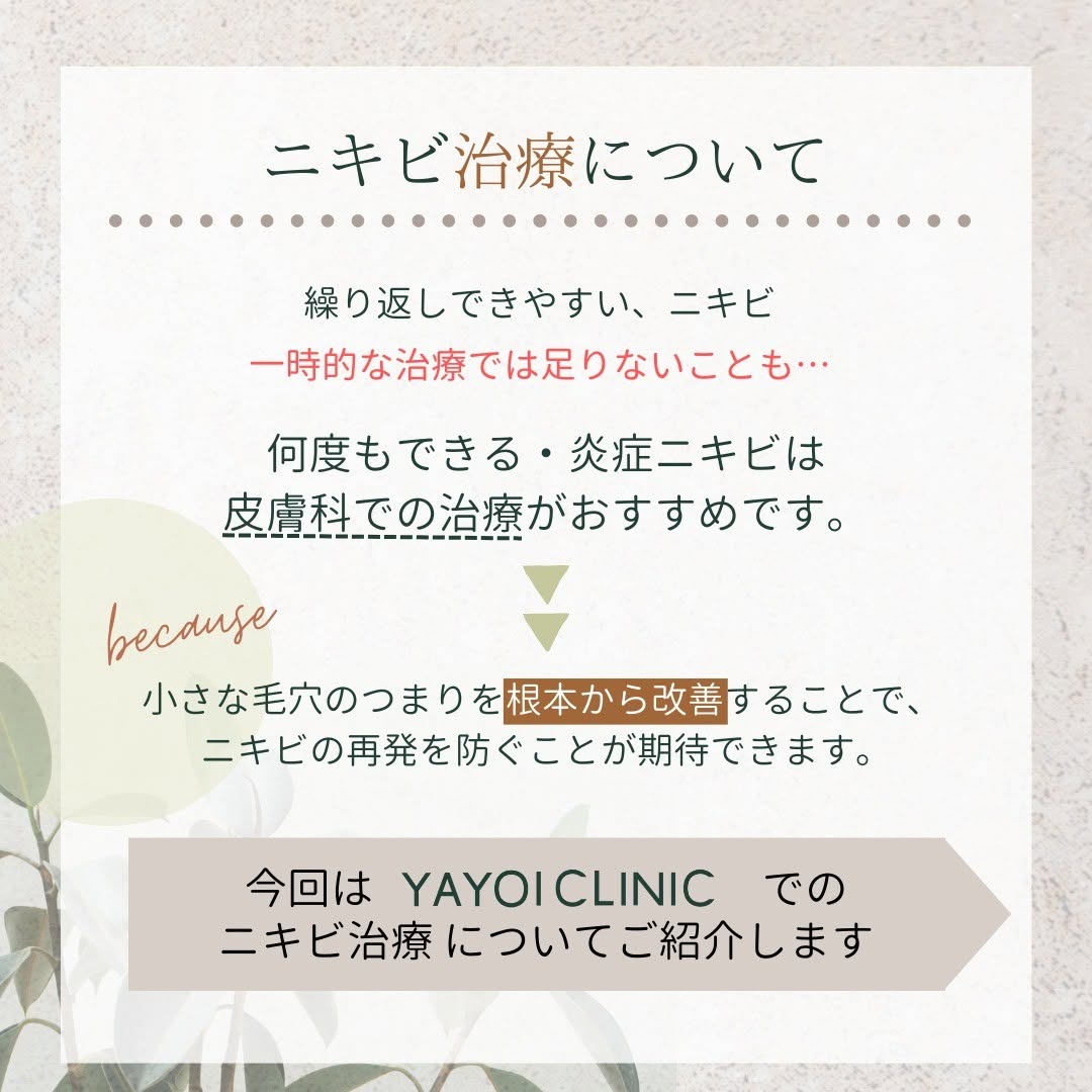 皮膚科のニキビ治療