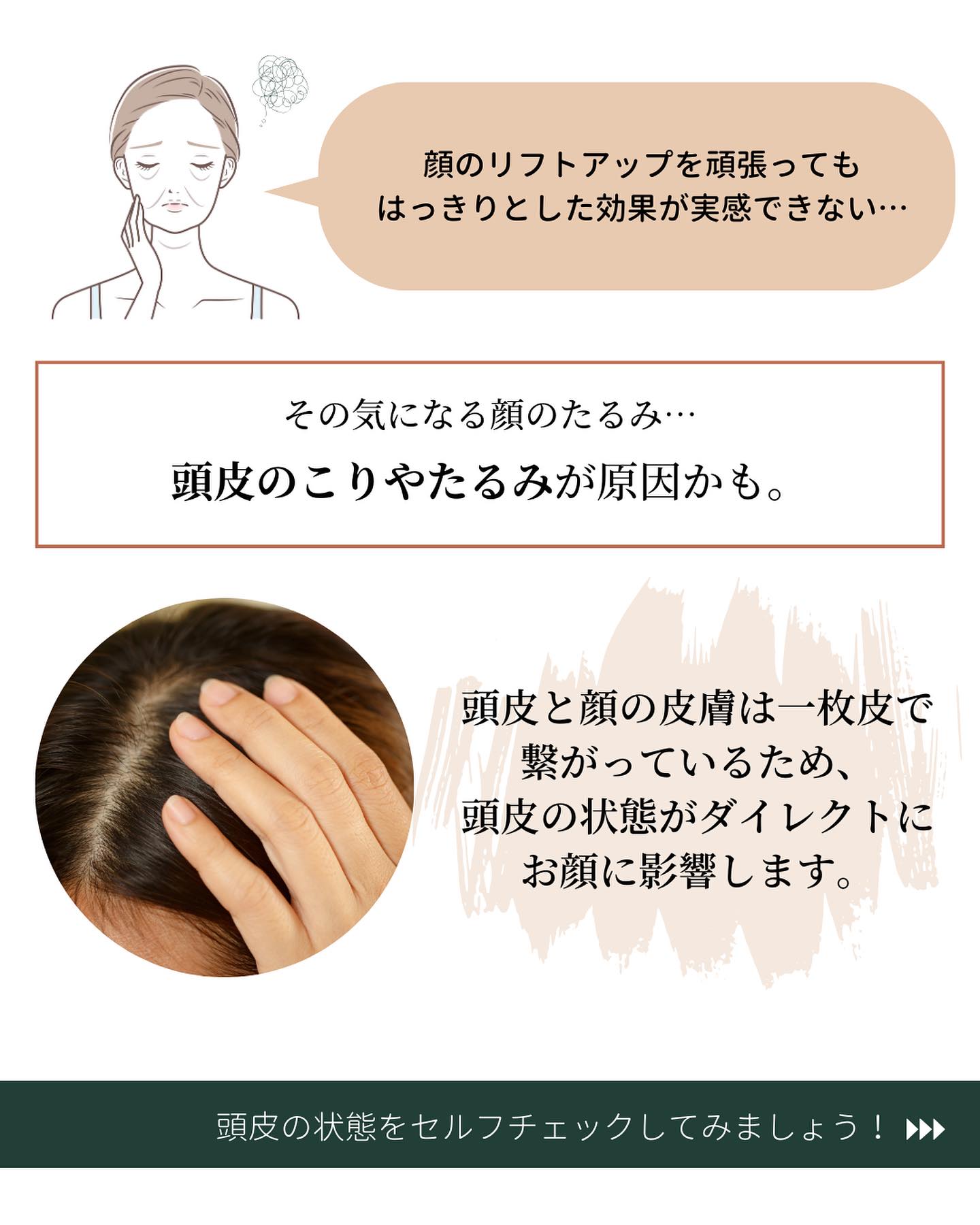 顔のたるみの原因は頭皮にある