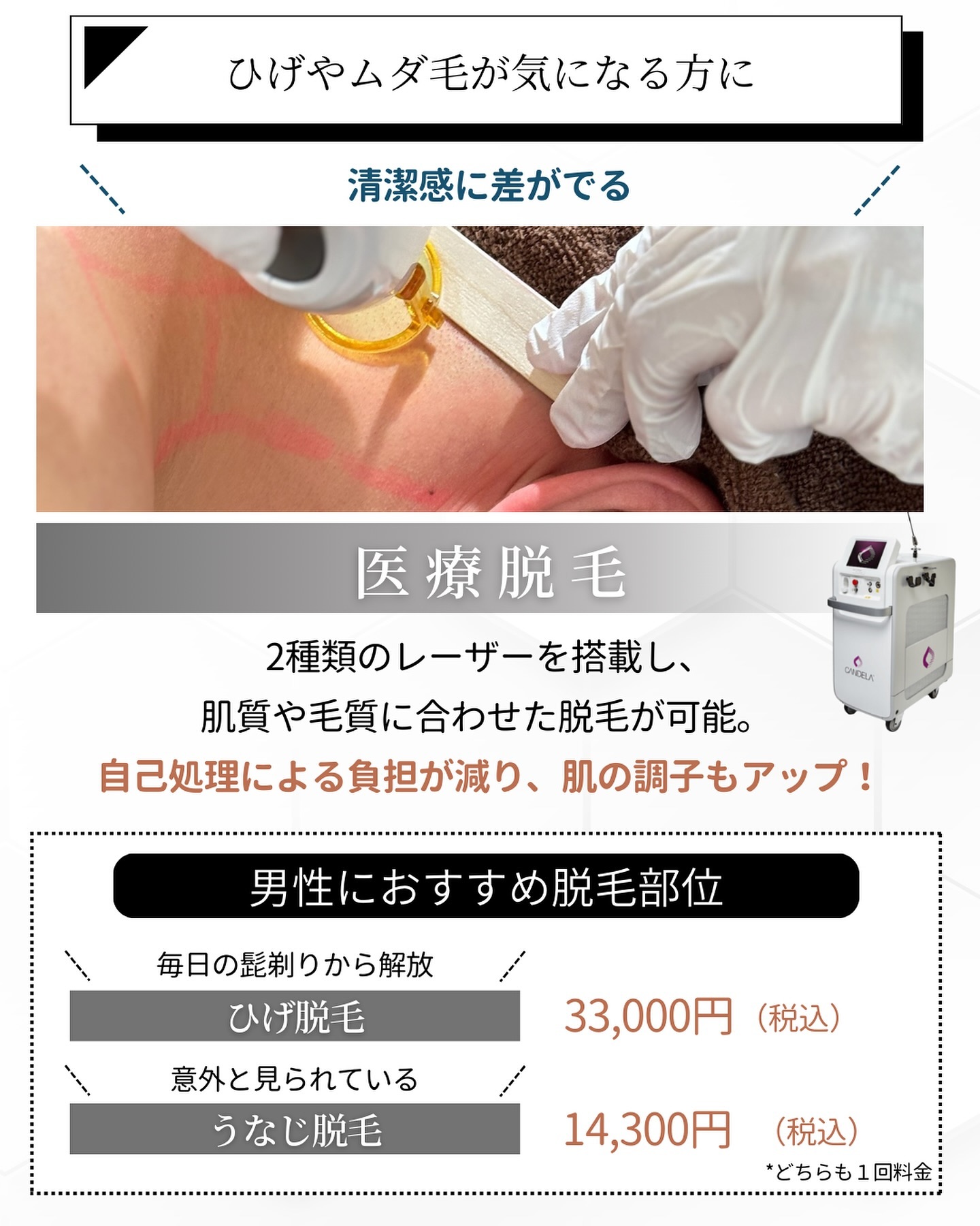 ひげやムダ毛が気になる方に