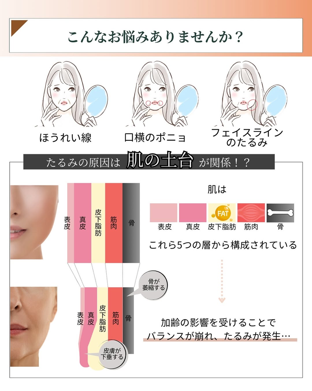 たるみの原因は肌の土台が関係