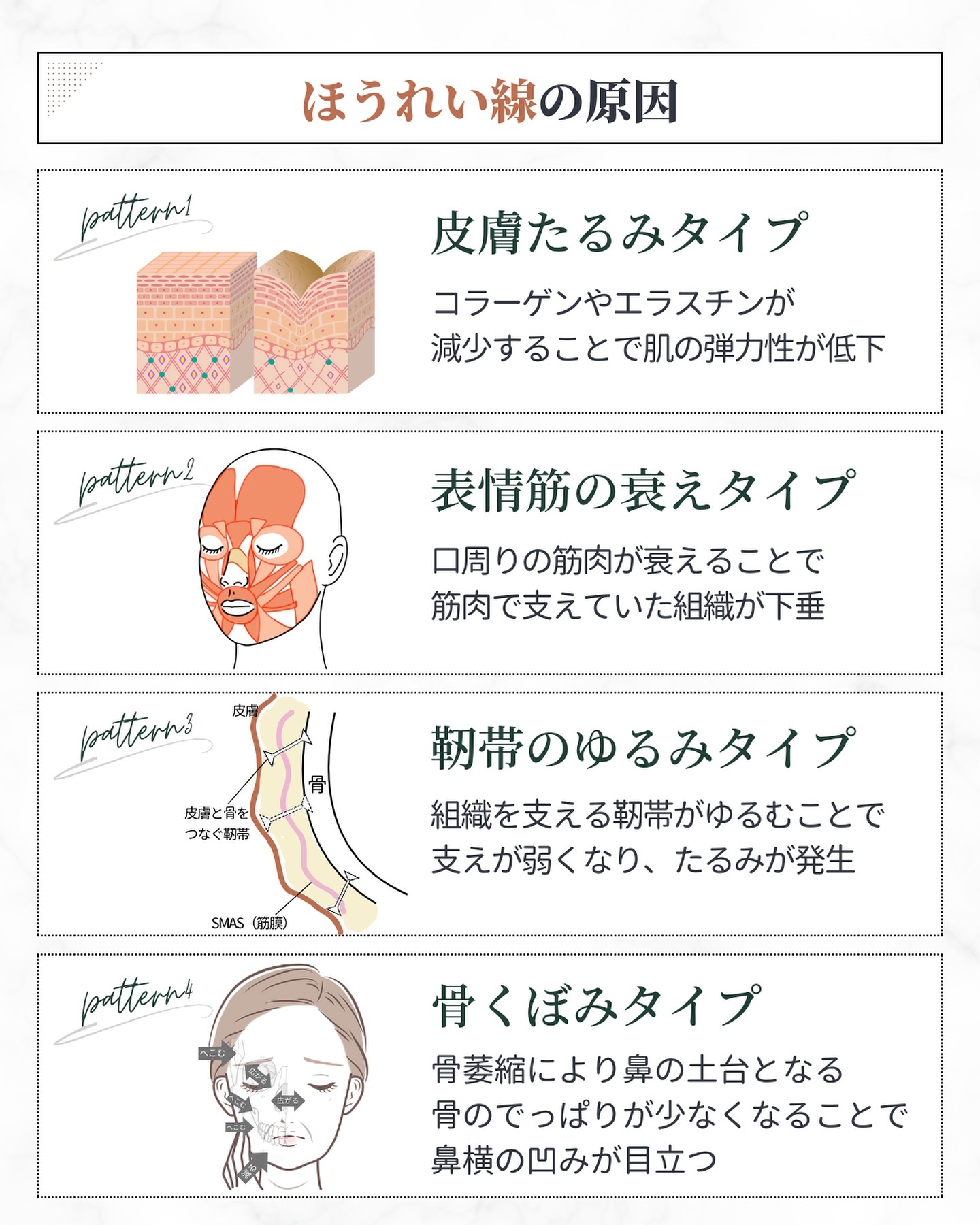 ほうれい線の原因