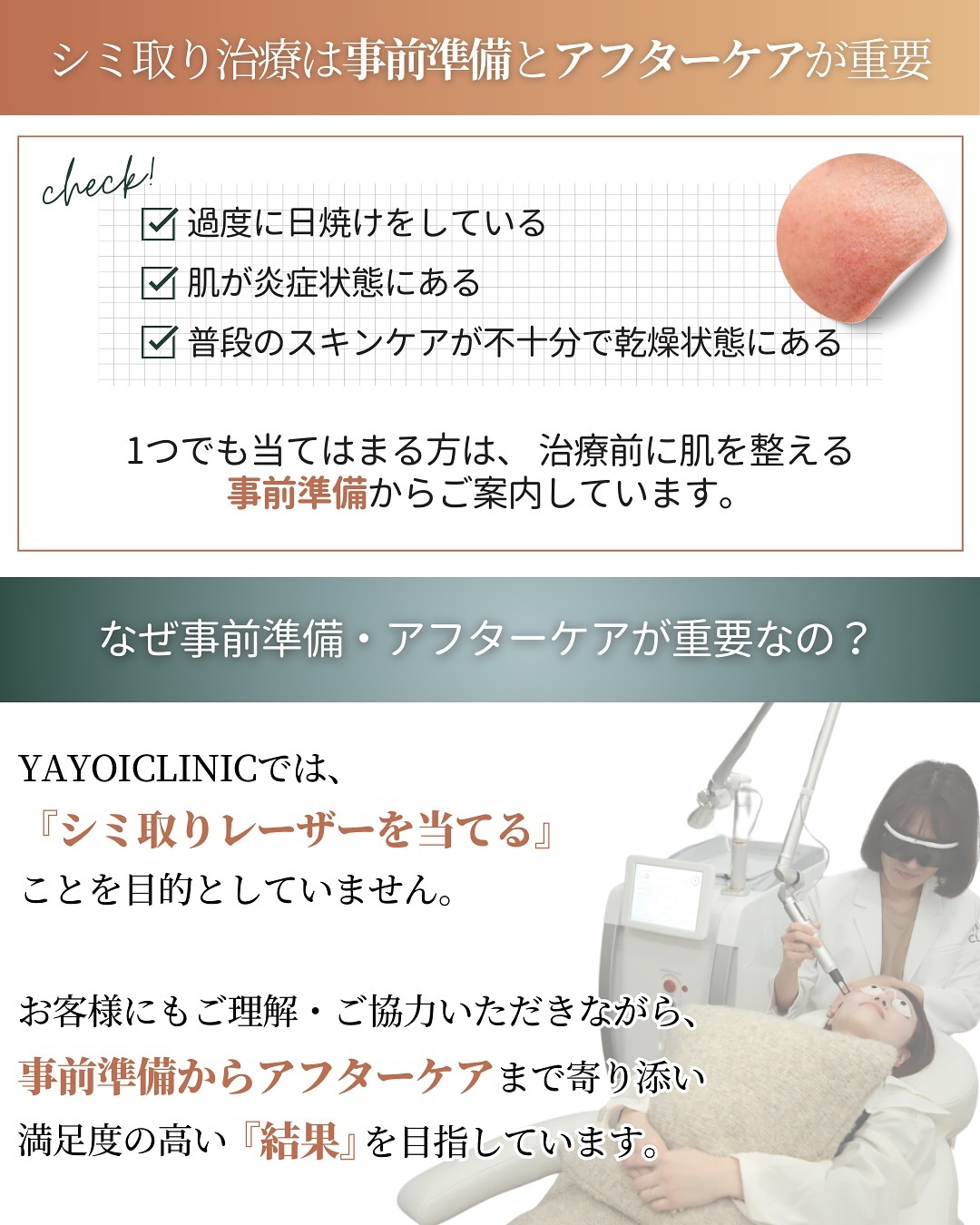 シミ取りレーザーの注意点