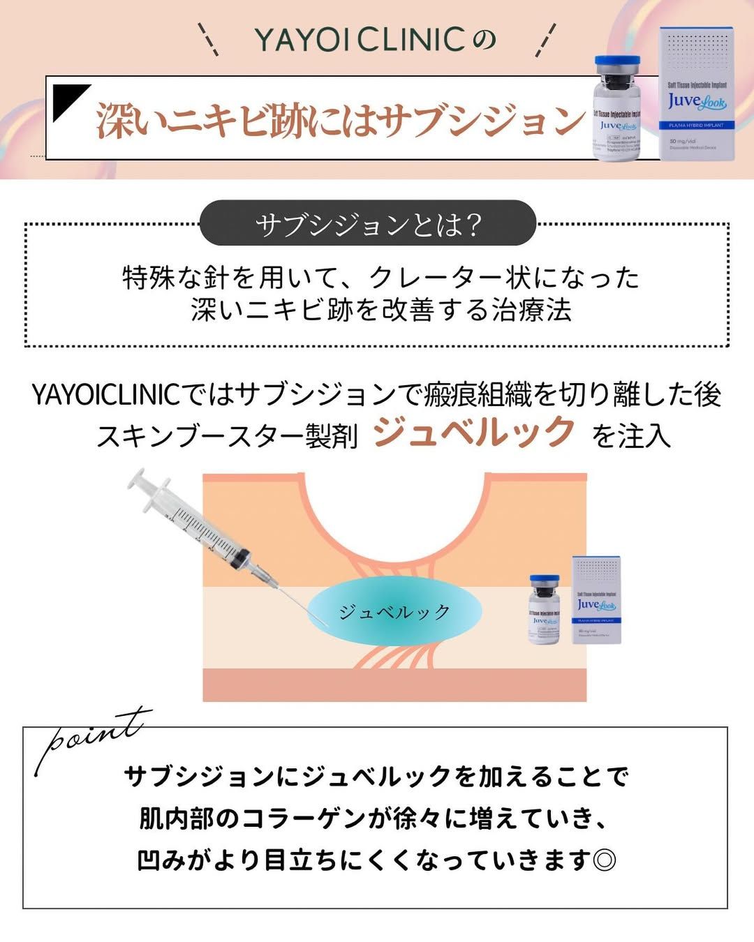 深いニキビ痕にはサブシジョン