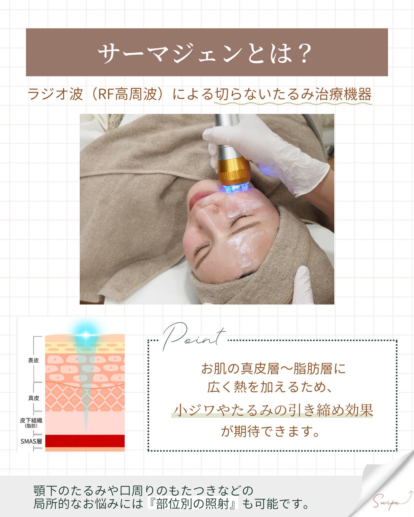 サーマジェン　施術内容