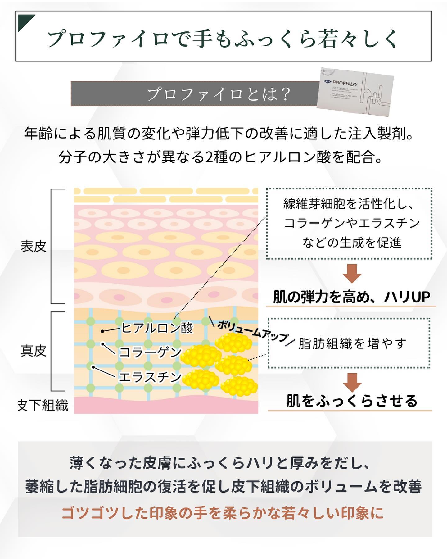 プロファイロ 効果