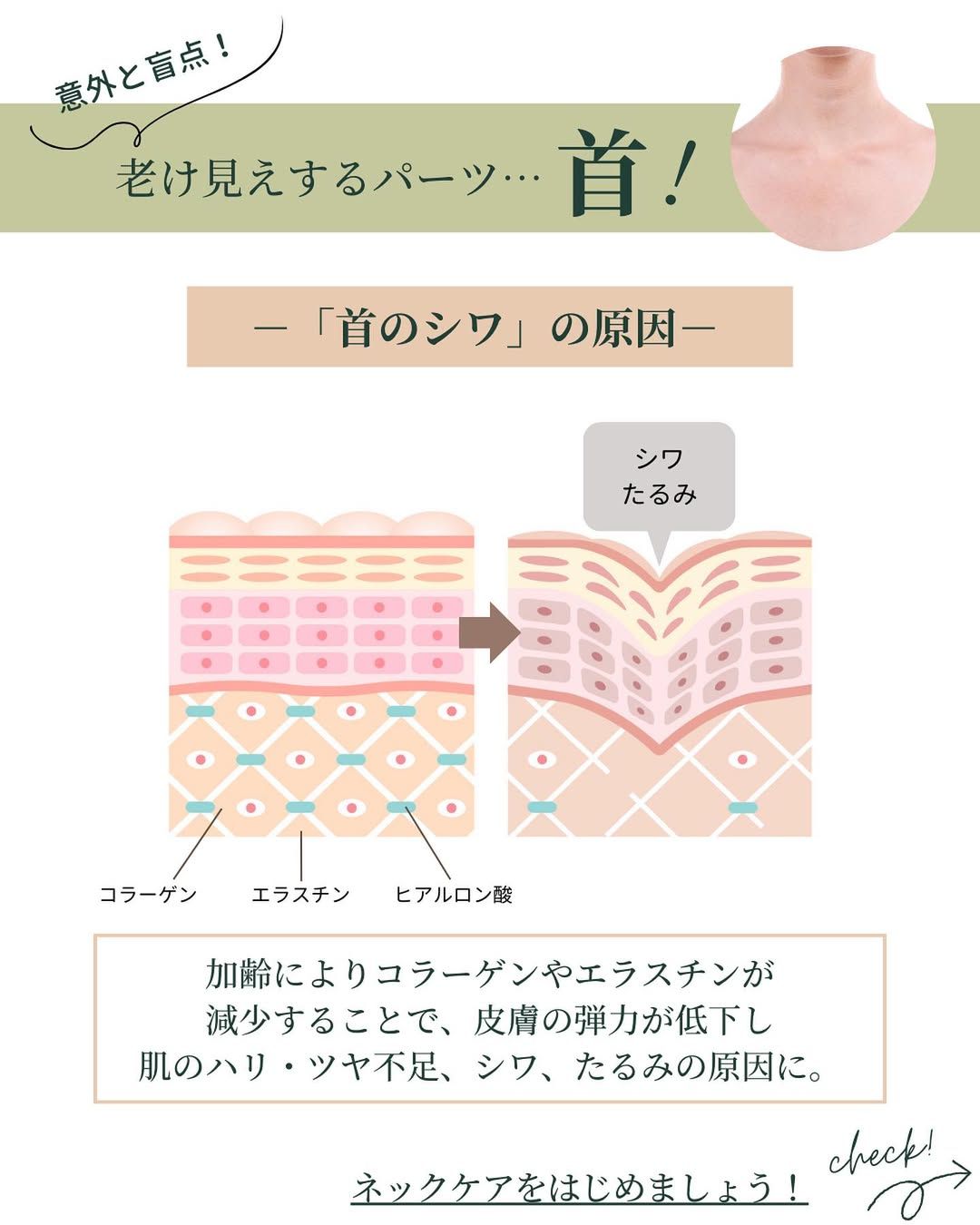 首のシワの原因